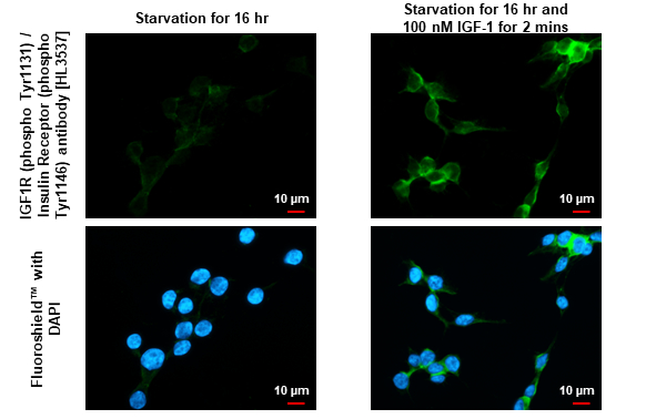 IGF1R (phospho Tyr1131) / Insulin Receptor (phospho Tyr1146) antibody [HL3537] detects IGF1R (phospho Tyr1131) / Insulin Receptor (phospho Tyr1146) protein by immunofluorescent analysis. Sample: Mock and treated 293T cells were fixed in 4% paraformaldehyde at RT for 15 min. Green: IGF1R (phospho Tyr1131) / Insulin Receptor (phospho Tyr1146) stained by IGF1R (phospho Tyr1131) / Insulin Receptor (phospho Tyr1146) antibody [HL3537] (GTX641434) diluted at 1:500. Blue: Fluoroshield with DAPI (GTX30920).