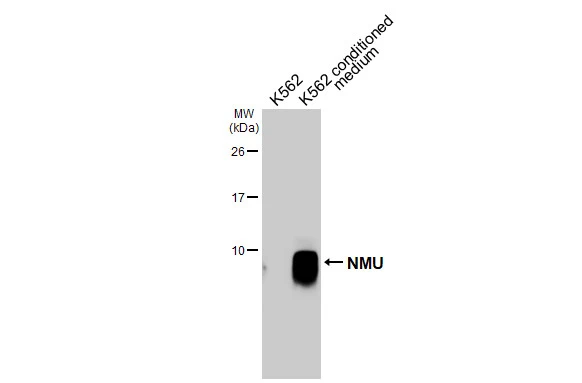 K562 whole cell extract and conditioned medium (30 μg) were separated by 15% SDS-PAGE, and the membrane was blotted with NMU antibody [HL3549] (GTX641455) diluted at 1:1000. The HRP-conjugated anti-rabbit IgG antibody (GTX213110-01) was used to detect the primary antibody.