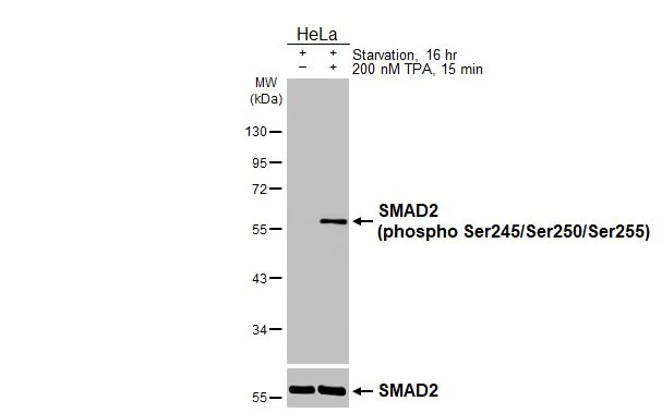 Untreated (–) and treated (+) HeLa whole cell extracts (30 μg) were separated by 10% SDS-PAGE, and the membranes were blotted with SMAD2 (phospho Ser245/Ser250/Ser255) antibody [HL3555] (GTX641461) diluted at 1:1000 and SMAD2 antibody (GTX111131) diluted at 1:1000. The HRP-conjugated anti-rabbit IgG antibody (GTX213110-01) was used to detect the primary antibody.