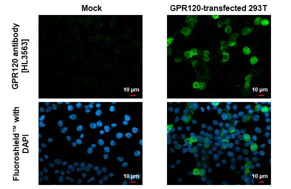 GPR120 antibody [HL3563] detects GPR120 protein by immunofluorescent analysis. Sample: Mock and transfected 293T cells were fixed in ice-cold MeOH for 5 min. Green: GPR120 stained by GPR120 antibody [HL3563] (GTX641469) diluted at 1:500. Blue: Fluoroshield with DAPI (GTX30920).