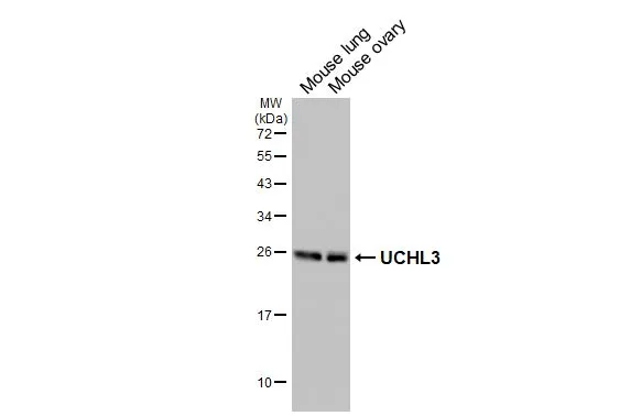 Various tissue extracts (50 μg) were separated by 12% SDS-PAGE, and the membrane was blotted with UCHL3 antibody [HL3564] (GTX641470) diluted at 1:1000. The HRP-conjugated anti-rabbit IgG antibody (GTX213110-01) was used to detect the primary antibody.