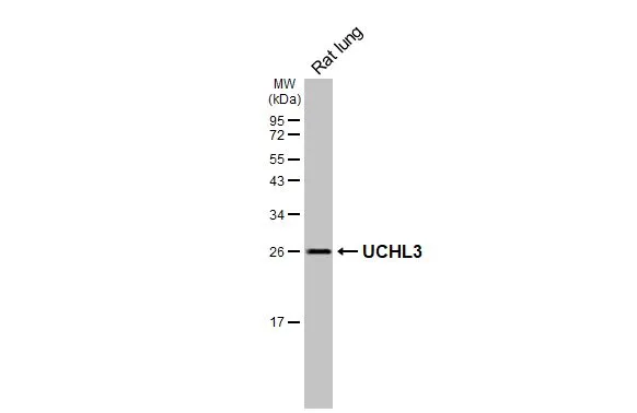 Rat tissue extract (50 μg) was separated by 12% SDS-PAGE, and the membrane was blotted with UCHL3 antibody [HL3564] (GTX641470) diluted at 1:1000. The HRP-conjugated anti-rabbit IgG antibody (GTX213110-01) was used to detect the primary antibody.