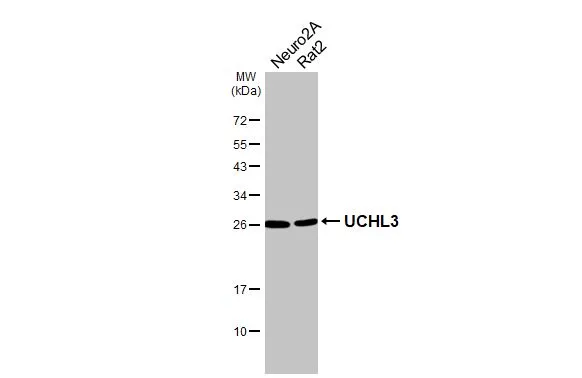 Various whole cell extracts (30 μg) were separated by 12% SDS-PAGE, and the membrane was blotted with UCHL3 antibody [HL3564] (GTX641470) diluted at 1:1000. The HRP-conjugated anti-rabbit IgG antibody (GTX213110-01) was used to detect the primary antibody.
