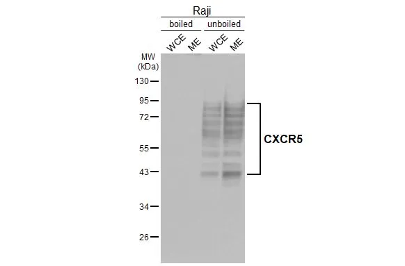 Boiled and unboiled Raji whole cell and membrane extracts (30 μg) were separated by 10% SDS-PAGE, and the membrane was blotted with CXCR5 antibody [HL3568] (GTX641474) diluted at 1:1000. The HRP-conjugated anti-rabbit IgG antibody (GTX213110-01) was used to detect the primary antibody.