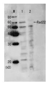 Western blot analysis of Rad22 protein in the whole cell extracts with anti-Rad22 serum before affinity purification. M: Molecular weight markers (kD) Lane1: Wild-type strain Lane2: Rad22 deletion mutant strain Western blot analysis of Rad22 protein in the whole cell extracts with anti-Rad22 serum before affinity purification. M: Molecular weight markers (kD) Lane1: Wild-type strain Lane2: Rad22 deletion mutant strain