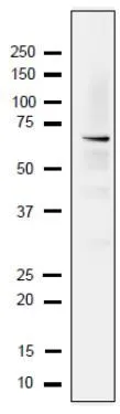Detection of endogenous Rfa1 protein in whole cell extract of S.cerevisiae. The extract of strain BY4741 (10 microg) was separated on SDS-PAGE 10-20% gradient gel. The anti-Rfa1 antibody was used at 1/2,000 dilution. As the second antibody, HRP-conjugated goat anti-rabbit IgG was used at 1/10,000 dilution Detection of endogenous Rfa1 protein in whole cell extract of S.cerevisiae. The extract of strain BY4741 (10 microg) was separated on SDS-PAGE 10-20% gradient gel. The anti-Rfa1 antibody was used at 1/2,000 dilution. As the second antibody, HRP-conjugated goat anti-rabbit IgG was used at 1/10,000 dilution