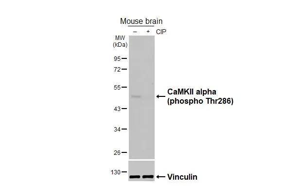 Untreated (–) and treated (+) mouse brain extract (50 μg) were separated by 10% SDS-PAGE, and the membrane was blotted with CaMKII alpha (phospho Thr286) antibody [HL3570] (GTX641517) diluted at 1:1000. The HRP-conjugated anti-rabbit IgG antibody (GTX213110-01) was used to detect the primary antibody, and the signal was developed with Trident ECL plus-Enhanced.