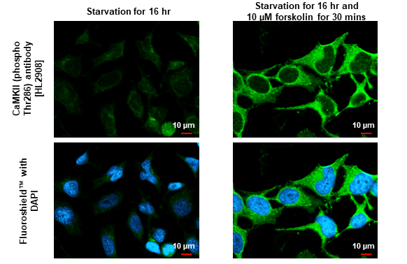CaMKII alpha (phospho Thr286) antibody [HL2908] detects CaMKII alpha (phospho Thr286) protein by immunofluorescent analysis. Sample: Mock and treated HeLa cells were fixed in ice-cold MeOH for 5 min. Green: CaMKII alpha (phospho Thr286) stained by CaMKII alpha (phospho Thr286) antibody [HL2908] (GTX641517) diluted at 1:500. Blue: Fluoroshield with DAPI (GTX30920).