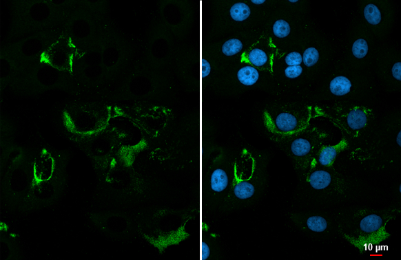 Anti-dsRNA antibody [J2] (GTX641519) | GeneTex
