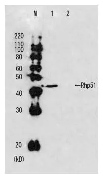 Western blot analysis of Rhp51 in the whole cell extracts. M: Molecular size markers (kD) Lane 1: Wild-type strain Lane2: Rhp51 deletion mutant strain