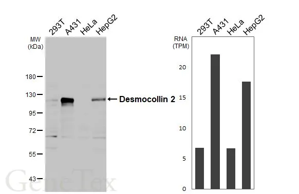Various whole cell extracts (30 μg) were separated by 7.5% SDS-PAGE, and the membrane was blotted with Desmocollin 2 antibody [HL3572] (GTX641543) diluted at 1:1000. The HRP-conjugated anti-rabbit IgG antibody (GTX213110-01) was used to detect the primary antibody. Corresponding RNA expression data for the same cell lines are based on Human Protein Atlas program.