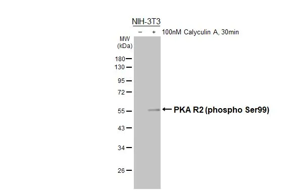 Untreated (–) and treated (+) NIH-3T3 whole cell extracts (30 μg) were separated by 10% SDS-PAGE, and the membrane was blotted with PKA R2 (phospho Ser99) antibody [HL3583] (GTX641554) diluted at 1:1000. The HRP-conjugated anti-rabbit IgG antibody (GTX213110-01) was used to detect the primary antibody, and the signal was developed with Trident ECL plus-Enhanced.