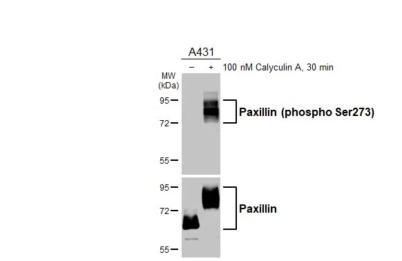 Untreated (–) and treated (+) A431 whole cell extracts (30 μg) were separated by 7.5% SDS-PAGE, and the membranes were blotted with Paxillin (phospho Ser273) antibody [HL3588] (GTX641559) diluted at 1:1000 and Paxillin antibody (GTX125891) diluted at 1:1000. The HRP-conjugated anti-rabbit IgG antibody (GTX213110-01) was used to detect the primary antibody.