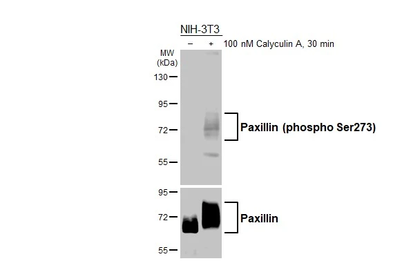 Untreated (–) and treated (+) NIH-3T3 whole cell extracts (30 μg) were separated by 7.5% SDS-PAGE, and the membranes were blotted with Paxillin (phospho Ser273) antibody [HL3588] (GTX641559) diluted at 1:1000 and Paxillin antibody (GTX125891) diluted at 1:1000. The HRP-conjugated anti-rabbit IgG antibody (GTX213110-01) was used to detect the primary antibody.