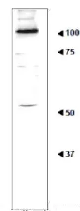 Detection of Rpn1 in the crude extract of S. cerevisiae by Western blotting using this antibody Crude cell extract of S. cerevisiae (20 ug) was analysed by western blotting using anti-Rpn1 antibody at 1/1,000 dilution. Blotting should be done in wet system. Molecular mass of Rpn1 is 109 kDa Detection of Rpn1 in the crude extract of S. cerevisiae by Western blotting using this antibody Crude cell extract of S. cerevisiae (20 ug) was analysed by western blotting using anti-Rpn1 antibody at 1/1,000 dilution. Blotting should be done in wet system. Molecular mass of Rpn1 is 109 kDa