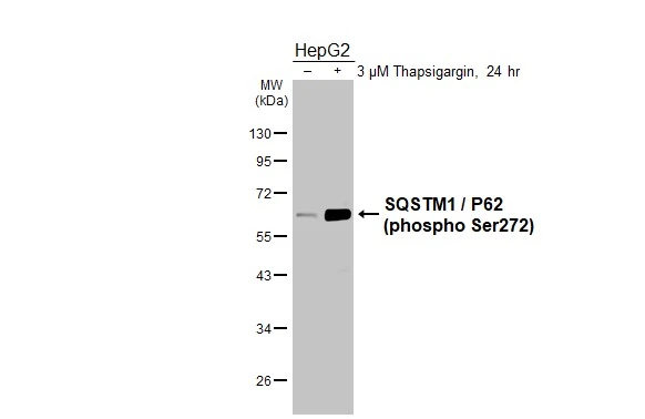 Untreated (–) and treated (+) HepG2 whole cell extract (30 μg) were separated by 10% SDS-PAGE, and the membrane was blotted with SQSTM1 / P62 (phospho Ser272) antibody [HL3591] (GTX641562) diluted at 1:1000. The HRP-conjugated anti-rabbit IgG antibody (GTX213110-01) was used to detect the primary antibody.