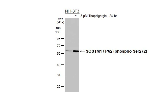 Untreated (–) and treated (+) NIH-3T3 whole cell extracts (30 μg) were separated by 10% SDS-PAGE, and the membrane was blotted with SQSTM1 / P62 (phospho Ser272) antibody [HL3591] (GTX641562) diluted at 1:1000. The HRP-conjugated anti-rabbit IgG antibody (GTX213110-01) was used to detect the primary antibody.