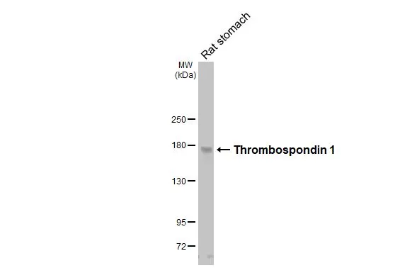 Rat tissue extract (50 μg) was separated by 5% SDS-PAGE, and the membrane was blotted with Thrombospondin 1 antibody [HL3593] (GTX641564) diluted at 1:1000. The HRP-conjugated anti-rabbit IgG antibody (GTX213110-01) was used to detect the primary antibody, and the signal was developed with Trident ECL plus-Enhanced.
