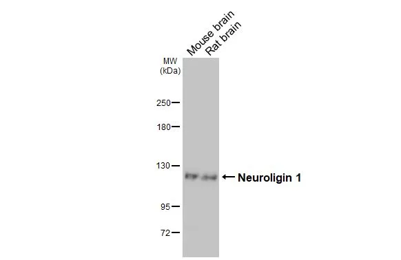 Various tissue extracts (50 μg) were separated by 5% SDS-PAGE, and the membrane was blotted with Neuroligin 1 antibody [GT63] (GTX641572) diluted at 1:1000. The HRP-conjugated anti-mouse IgG antibody (GTX213111-01) was used to detect the primary antibody, and the signal was developed with Trident ECL plus-Enhanced.