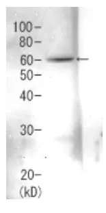 Detection of Rpn3 (60kDa) in the crude extract of S. cerevisiae by Western blotting using this antibody. Detection of Rpn3 (60kDa) in the crude extract of S. cerevisiae by Western blotting using this antibody.