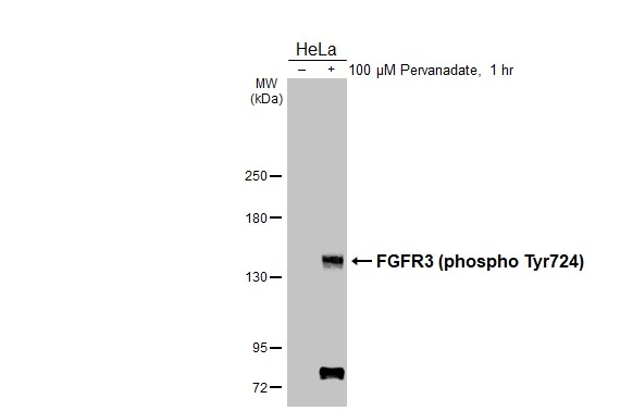 Untreated (–) and treated (+) HeLa whole cell extracts (30 μg) were separated by 5% SDS-PAGE, and the membrane was blotted with FGFR3 (phospho Tyr724) antibody [HL3612] (GTX641587) diluted at 1:185000. The HRP-conjugated anti-rabbit IgG antibody (GTX213110-01) was used to detect the primary antibody.