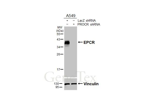 Non-transfected (–) and transfected (+) A549 whole cell extracts (30 μg) were separated by 12% SDS-PAGE, and the membrane was blotted with EPCR antibody [HL3619] (GTX641594) diluted at 1:1000. The HRP-conjugated anti-rabbit IgG antibody (GTX213110-01) was used to detect the primary antibody.