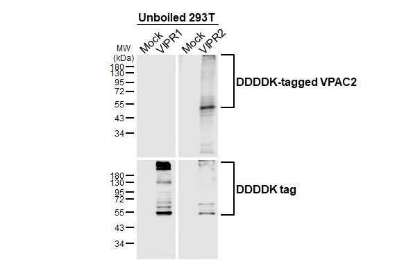Unboiled non-transfected (–) and transfected (+) 293T whole cell extracts (30 μg) were separated by 10% SDS-PAGE, and the membrane was blotted with VPAC2 antibody [HL3625] (GTX641600) diluted at 1:100000. The HRP-conjugated anti-rabbit IgG antibody (GTX213110-01) was used to detect the primary antibody.