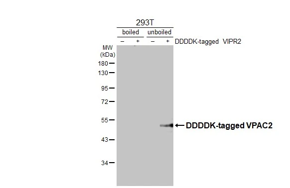Non-transfected (–) and transfected (+) boiled and unboiled 293T whole cell extracts (30 μg) were separated by 10% SDS-PAGE, and the membrane was blotted with VPAC2 antibody [HL3625] (GTX641600) diluted at 1:5000. The HRP-conjugated anti-rabbit IgG antibody (GTX213110-01) was used to detect the primary antibody.