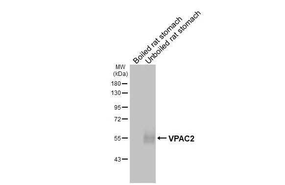 Boiled and unboiled rat tissue extracts (50 μg) were separated by 10% SDS-PAGE, and the membrane was blotted with VPAC2 antibody [HL3625] (GTX641600) diluted at 1:1000. The HRP-conjugated anti-rabbit IgG antibody (GTX213110-01) was used to detect the primary antibody.