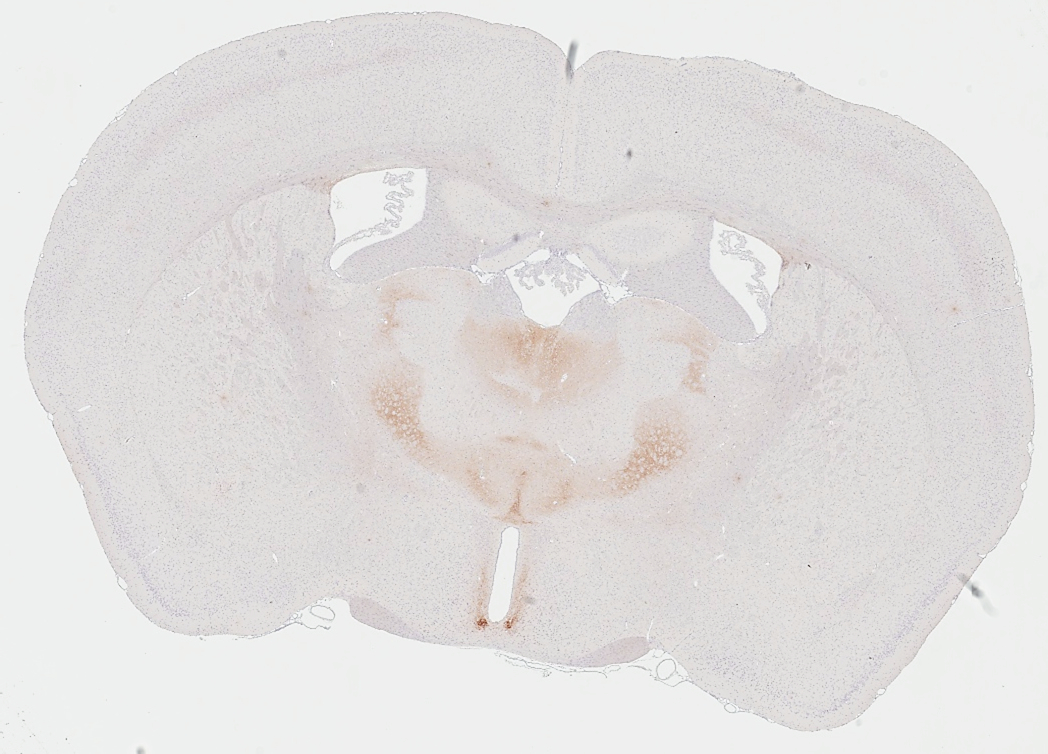 VPAC2 antibody [HL3625] detects VPAC2 protein by immunohistochemical analysis. Sample: Paraffin-embedded mouse brain. VPAC2 stained by VPAC2 antibody [HL3625] (GTX641600) diluted at 1:200. Antigen Retrieval: Tris-EDTA buffer, pH 9.0, 15 min