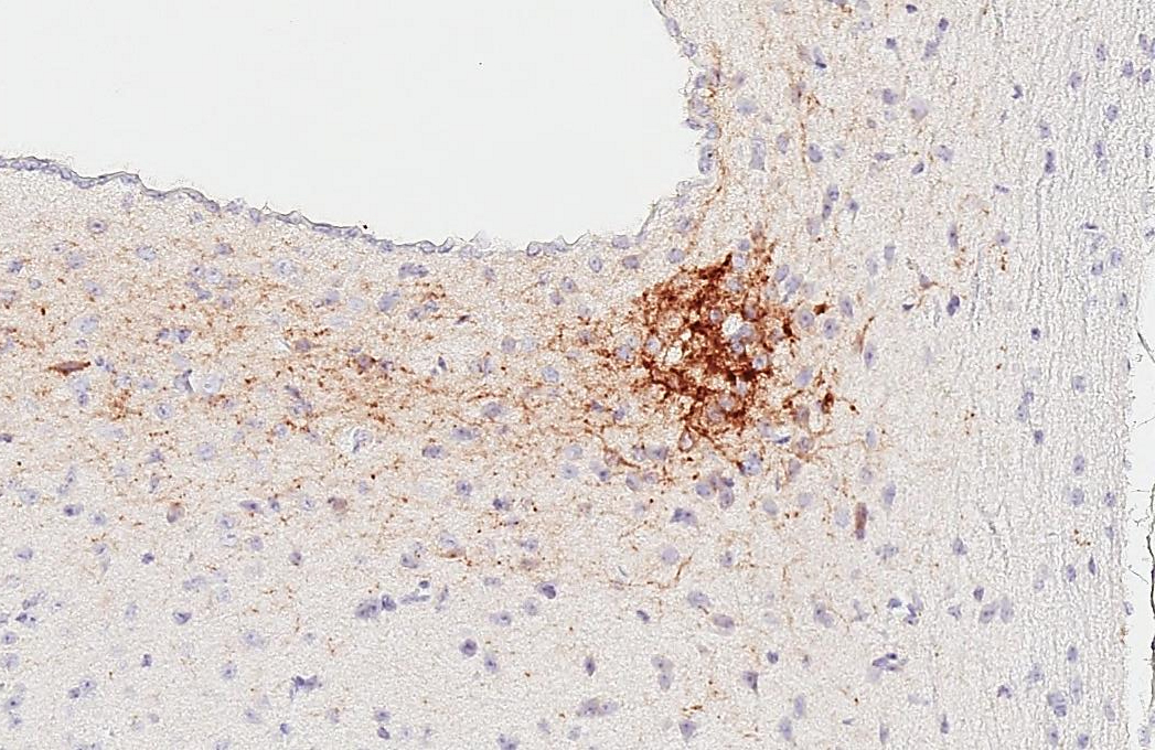 VPAC2 antibody [HL3625] detects VPAC2 protein at suprachiasmatic nucleus by immunohistochemical analysis. Sample: Paraffin-embedded mouse brain. VPAC2 stained by VPAC2 antibody [HL3625] (GTX641600) diluted at 1:200. Antigen Retrieval: Tris-EDTA buffer, pH 9.0, 15 min