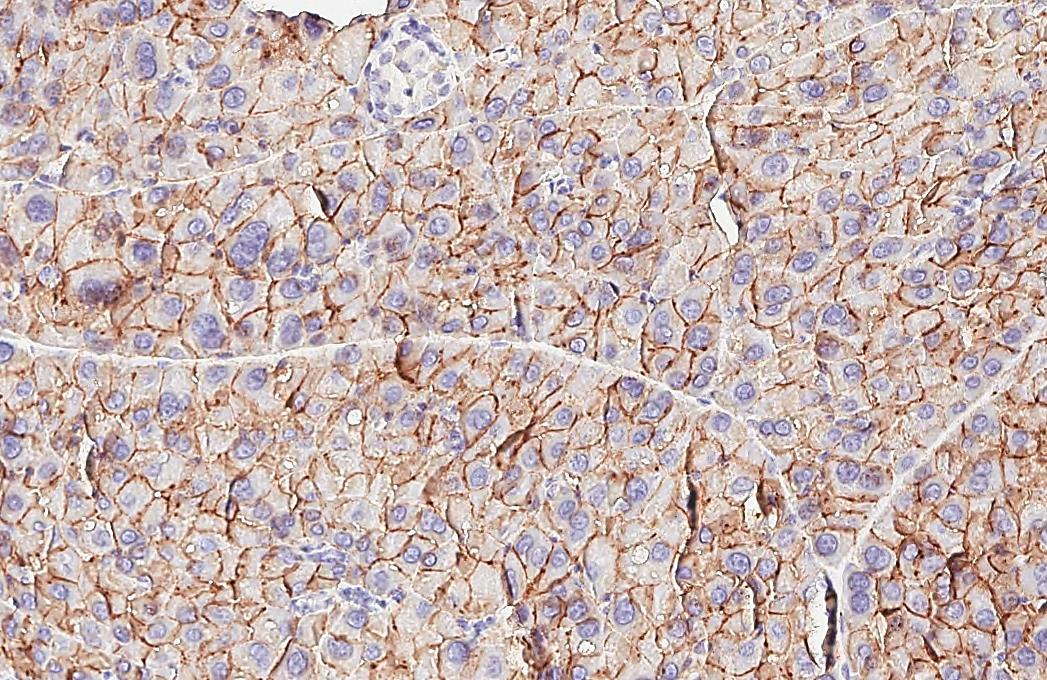 VPAC2 antibody [HL3625] detects VPAC2 protein by immunohistochemical analysis. Sample: Paraffin-embedded mouse pancreas. VPAC2 stained by VPAC2 antibody [HL3625] (GTX641600) diluted at 1:200. Antigen Retrieval: Tris-EDTA buffer, pH 9.0, 15 min