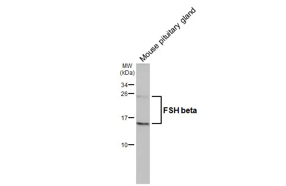 Mouse tissue extract (50 μg) was separated by 15% SDS-PAGE, and the membrane was blotted with FSH beta antibody [GT64] (GTX641602) diluted at 1:1000. The HRP-conjugated anti-mouse IgG antibody (GTX213111-01) was used to detect the primary antibody.