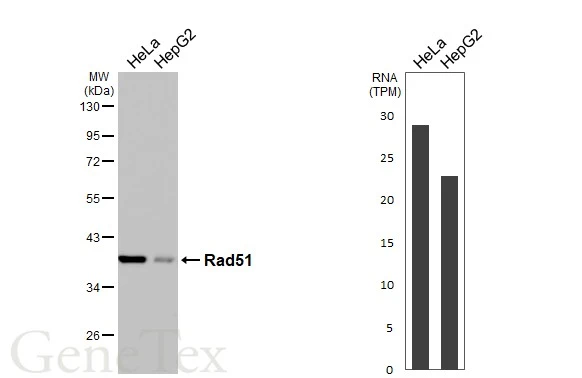 Various whole cell extracts (30 μg) were separated by 10% SDS-PAGE, and the membrane was blotted with Rad51 antibody [HL3628] (GTX641619) diluted at 1:1000. The HRP-conjugated anti-rabbit IgG antibody (GTX213110-01) was used to detect the primary antibody. Corresponding RNA expression data for the same cell lines are based on Human Protein Atlas program.
