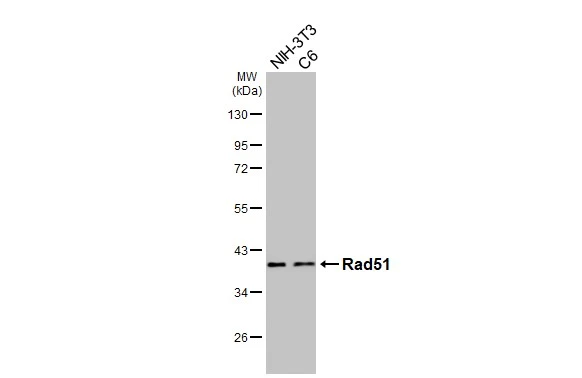 Various whole cell extracts (30 μg) were separated by 10% SDS-PAGE, and the membrane was blotted with Rad51 antibody [HL3628] (GTX641619) diluted at 1:1000. The HRP-conjugated anti-rabbit IgG antibody (GTX213110-01) was used to detect the primary antibody.