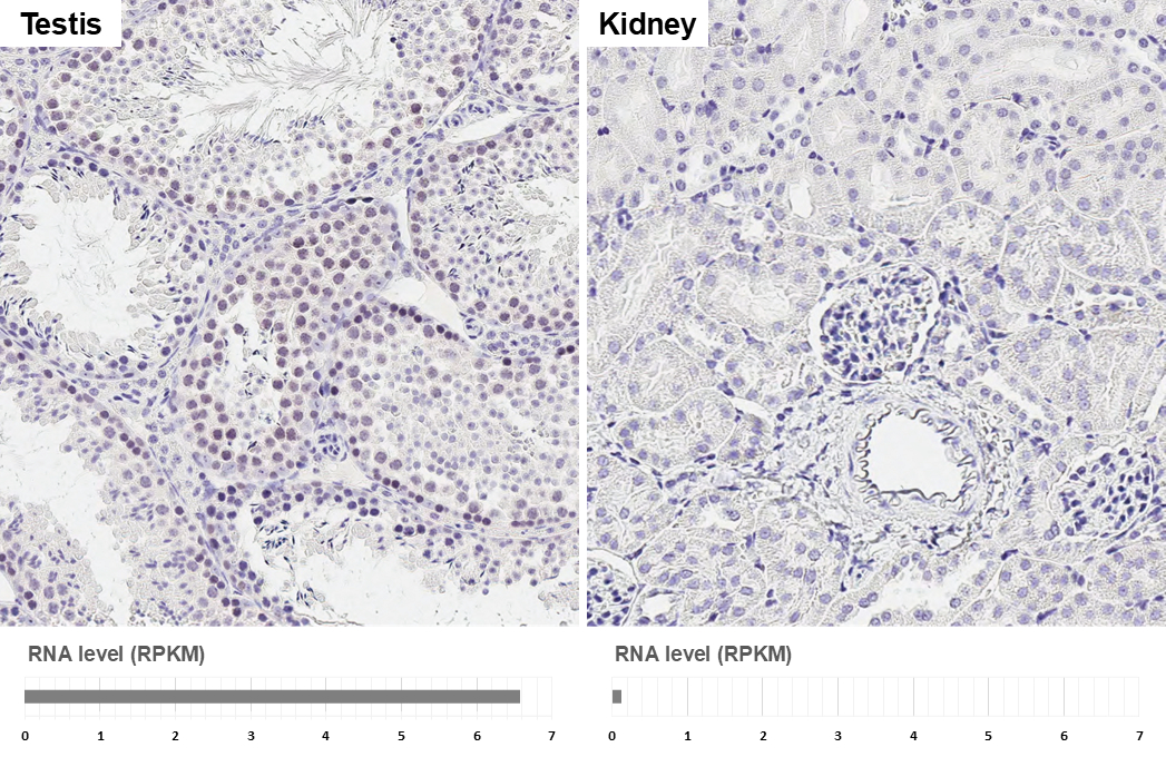 Rad51 antibody [HL3628] detects Rad51 protein by immunohistochemical analysis. Sample: Paraffin-embedded mouse tissues. Rad51 stained by Rad51 antibody [HL3628] (GTX641619) diluted at 1:200. Antigen Retrieval: Citrate buffer, pH 6.0, 15 min