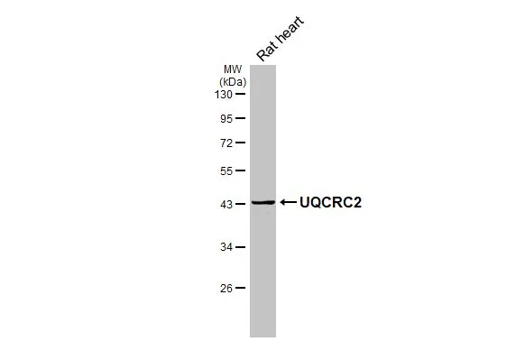 Rat tissue extract (50 μg) was separated by 10% SDS-PAGE, and the membrane was blotted with UQCRC2 antibody [HL3638] (GTX641629) diluted at 1:1000. The HRP-conjugated anti-rabbit IgG antibody (GTX213110-01) was used to detect the primary antibody.