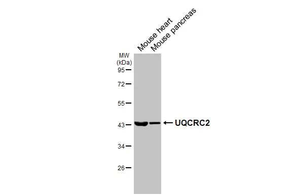 Various tissue extracts (50 μg) were separated by 10% SDS-PAGE, and the membrane was blotted with UQCRC2 antibody [HL3638] (GTX641629) diluted at 1:1000. The HRP-conjugated anti-rabbit IgG antibody (GTX213110-01) was used to detect the primary antibody.