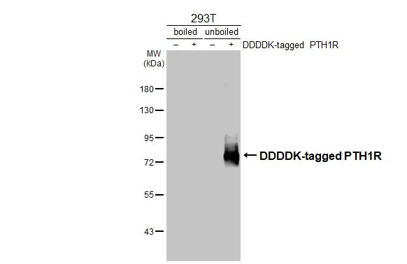 Non-transfected (–) and transfected (+) boiled and unboiled 293T whole cell extracts (30 μg) were separated by 7.5% SDS-PAGE, and the membrane was blotted with PTH1R antibody [HL3651] (GTX641642) diluted at 1:5000. The HRP-conjugated anti-rabbit IgG antibody (GTX213110-01) was used to detect the primary antibody.