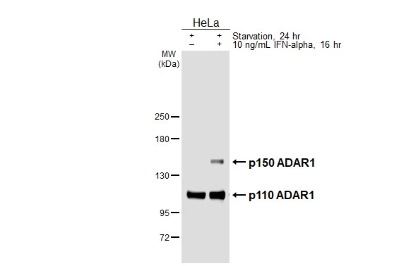 Untreated (–) and treated (+) HeLa whole cell extracts (30 μg) were separated by 5% SDS-PAGE, and the membrane was blotted with ADAR1 antibody [HL3666] (GTX641694) diluted at 1:1000. The HRP-conjugated anti-rabbit IgG antibody (GTX213110-01) was used to detect the primary antibody.