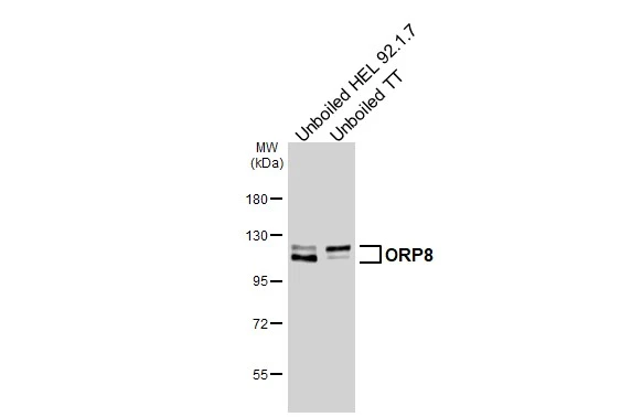 Unboiled various whole cell extracts (30 μg) were separated by 7.5% SDS-PAGE, and the membrane was blotted with ORP8 antibody [HL3674] (GTX641702) diluted at 1:1000. The HRP-conjugated anti-rabbit IgG antibody (GTX213110-01) was used to detect the primary antibody.