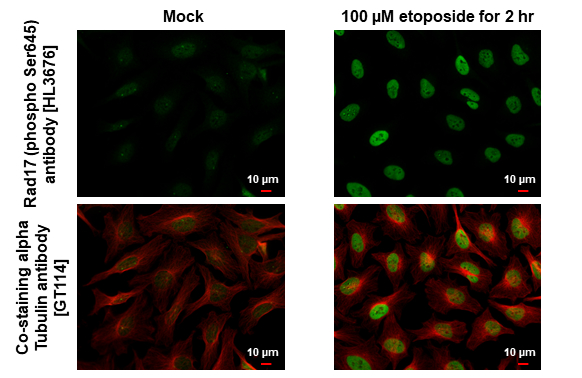 Rad17 (phospho Ser645) antibody [HL3676] detects Rad17 (phospho Ser645) protein by immunofluorescent analysis. Sample: Mock and treated HeLa cells were fixed in 4% paraformaldehyde at RT for 15 min. Green: Rad17 (phospho Ser645) stained by Rad17 (phospho Ser645) antibody [HL3676] (GTX641704) diluted at 1:500. Red: alpha Tubulin, a cytoskeleton marker, stained by alpha Tubulin antibody [GT114] (GTX628802) diluted at 1:1000.