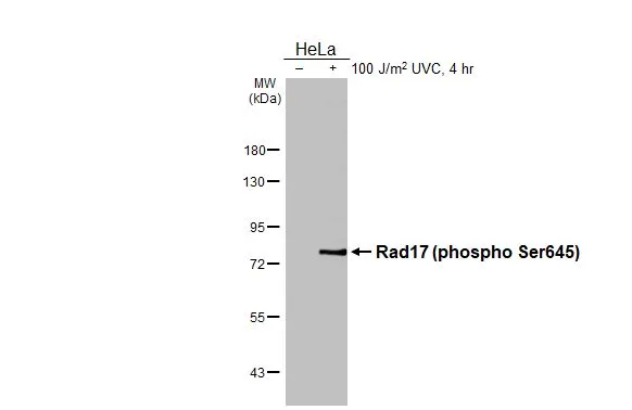 Untreated (–) and treated (+) HeLa whole cell extracts (30 μg) were separated by 7.5% SDS-PAGE, and the membranes were blotted with Rad17 (phospho Ser645) antibody [HL3676] (GTX641704) diluted at 1:500 and competitor's antibody () diluted at 1:. The HRP-conjugated anti-rabbit IgG antibody (GTX213110-01) was used to detect the primary antibody.
