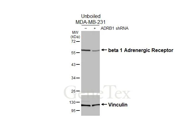 Non-transfected (–) and transfected (+) unboiled MDA-MB-231 whole cell extracts (30 μg) were separated by 10% SDS-PAGE, and the membrane was blotted with beta 1 Adrenergic Receptor antibody [HL3678] (GTX641706) diluted at 1:1000. The HRP-conjugated anti-rabbit IgG antibody (GTX213110-01) was used to detect the primary antibody.