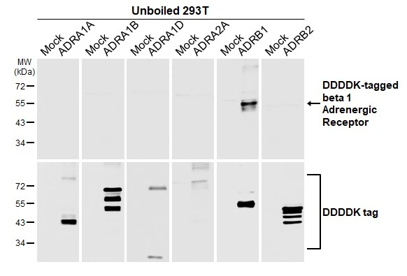 Unboiled non-transfected (–) and transfected (+) 293T whole cell extracts (30 μg) were separated by 10% SDS-PAGE, and the membrane was blotted with beta 1 Adrenergic Receptor antibody [HL3678] (GTX641706) diluted at 1:5000. The HRP-conjugated anti-rabbit IgG antibody (GTX213110-01) was used to detect the primary antibody.