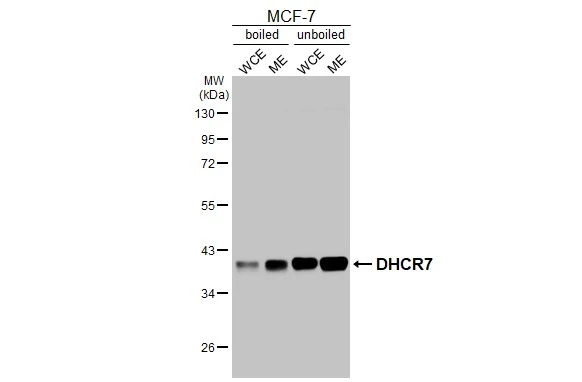 Boiled and unboiled MCF-7 whole cell extract (30 μg) were separated by 10% SDS-PAGE, and the membrane was blotted with DHCR7 antibody [HL3685] (GTX641713) diluted at 1:1000. The HRP-conjugated anti-rabbit IgG antibody (GTX213110-01) was used to detect the primary antibody. (WCE: whole cell extract; ME: membrane extract)