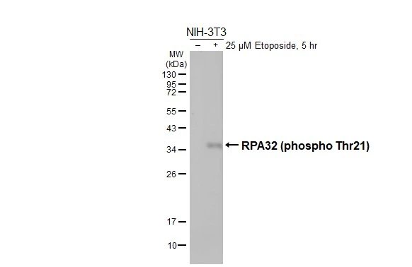 Untreated (–) and treated (+) NIH-3T3 whole cell extracts (30 μg) were separated by 12% SDS-PAGE, and the membrane was blotted with RPA32 (phospho Thr21) antibody [HL3692] (GTX641864) diluted at 1:1000. The HRP-conjugated anti-rabbit IgG antibody (GTX213110-01) was used to detect the primary antibody, and the signal was developed with Trident ECL plus-Enhanced.