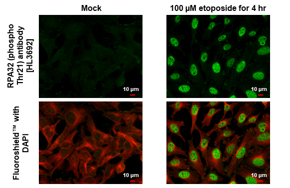 RPA32 (phospho Thr21) antibody [HL3692] detects RPA32 (phospho Thr21) protein by immunofluorescent analysis. Sample: Mock and treated HeLa cells were fixed in 4% paraformaldehyde at RT for 15 min. Green: RPA32 (phospho Thr21) stained by RPA32 (phospho Thr21) antibody [HL3692] (GTX641864) diluted at 1:500. Red: alpha Tubulin, a cytoskeleton marker, stained by alpha Tubulin antibody [GT114] (GTX628802) diluted at 1:1000.