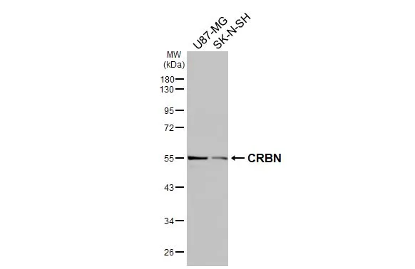 Various whole cell extracts (30 μg) were separated by 10% SDS-PAGE, and the membrane was blotted with CRBN antibody [HL3695] (GTX641867) diluted at 1:1000. The HRP-conjugated anti-rabbit IgG antibody (GTX213110-01) was used to detect the primary antibody.