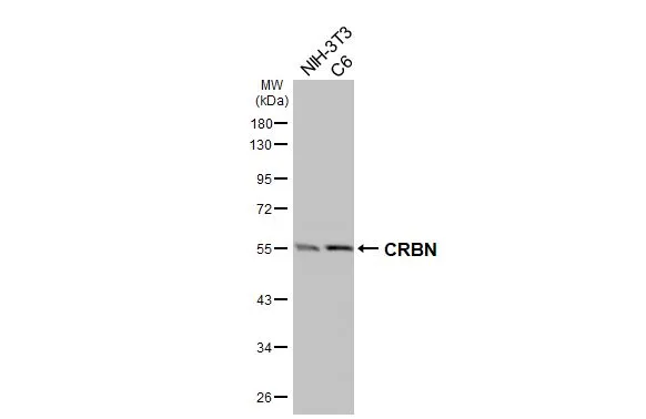 Various whole cell extracts (30 μg) were separated by 10% SDS-PAGE, and the membrane was blotted with CRBN antibody [HL3695] (GTX641867) diluted at 1:1000. The HRP-conjugated anti-rabbit IgG antibody (GTX213110-01) was used to detect the primary antibody.